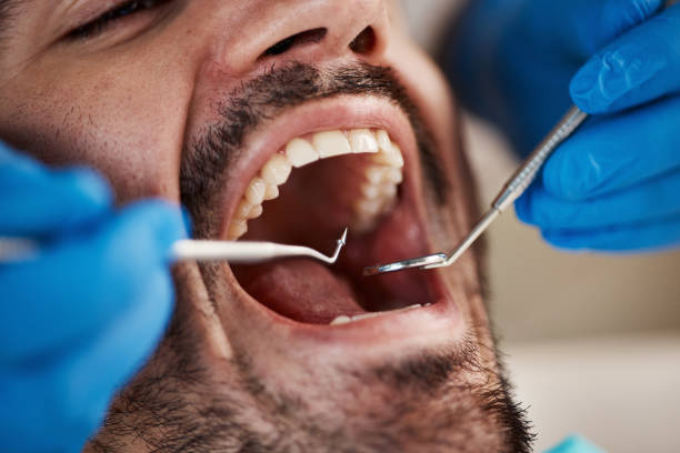 Best Emergency Dental Services for Seniors in Pontiac, MI