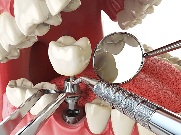 Best Weekend Emergency Dentist in Pontiac, MI